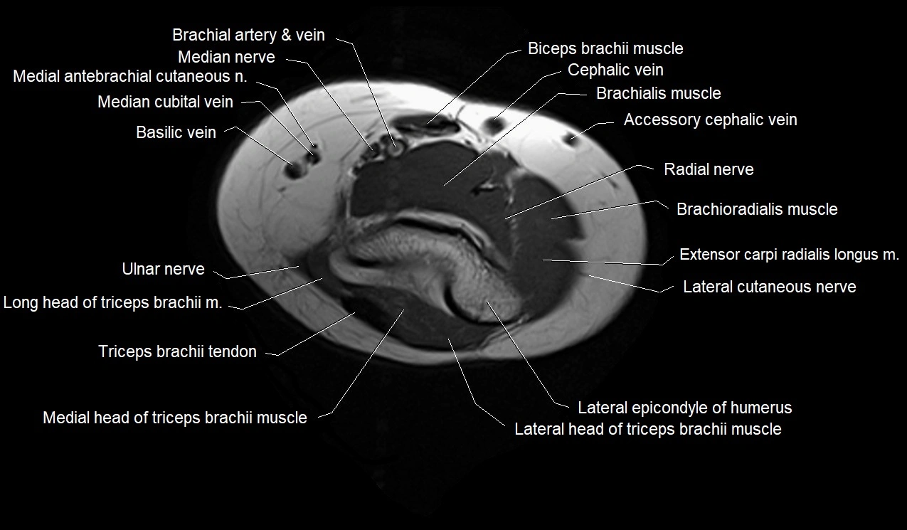 MRI 3T forearm axial cross sectional anatomy image 1.webp